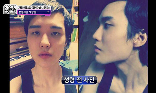 Anh chia sẻ đã từng cắt mí mắt, nâng mũi, gọt cằm, tiêm axít hyaluronic 5 lần vào cằm vì không thích cằm vuông. Chàng trai này còn bộc bạch anh không thích các cô gái có vẻ đẹp tự nhiên nên cũng bắt bạn gái phải phẫu thuật thẩm mỹ.