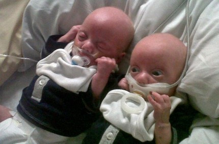 Trước đó, hồi tháng 1/2013, y tá của Bệnh viện Stafford (Anh) từng dùng băng dính dán chặt núm vú giả vào miệng bé trai sinh non, khiến dư luận nước này phẫn nộ. Nữ y tá này đã bị đình chỉ công tác ngay sau đó để phục vụ công tác điều tra.