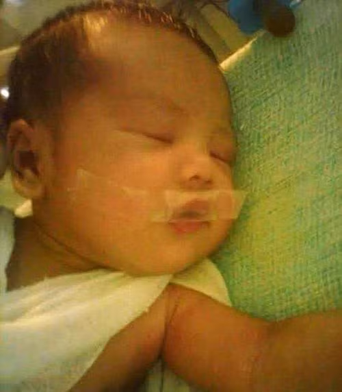 Ngày 12/5, anh Ryan Noval, cha của cậu bé 5 ngày tuổi Yohannes Noval, đăng những hình ảnh con trai nhỏ của mình bị dán miệng bằng một miếng băng dính do khóc gây tiếng ồn, lên Facebook.