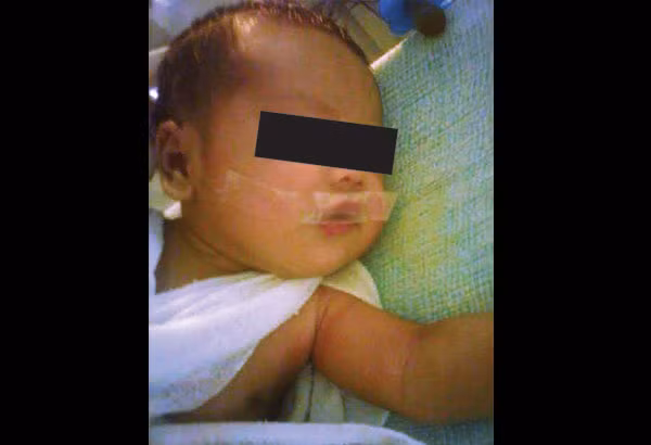 Hình ảnh em bé bị y tá dán băng dính lên miệng do khóc gây ồn trong bệnh viện.