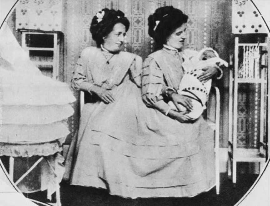 Khi cặp chị em sinh đôi Rosa và Josepha Blazek chào đời năm 1878 tại Tiệp Khắc, bà mẹ đã bị sốc khi thấy hai cô bé dính nhau ở phần cột sống và khung chậu. Dù bị bỏ đói nhiều ngày, nhưng hai cô bé vẫn cứ lớn lên mạnh khỏe, và dần dần trở thành một cặp “siêu sao” thu hút nhiều sự chú ý của khán giả trong các chương trình giải trí bên lề ở khắp châu Âu và Mỹ. Đến năm 1922 cả 2 anh em sinh đôi đều bị vàng da và qua đời.