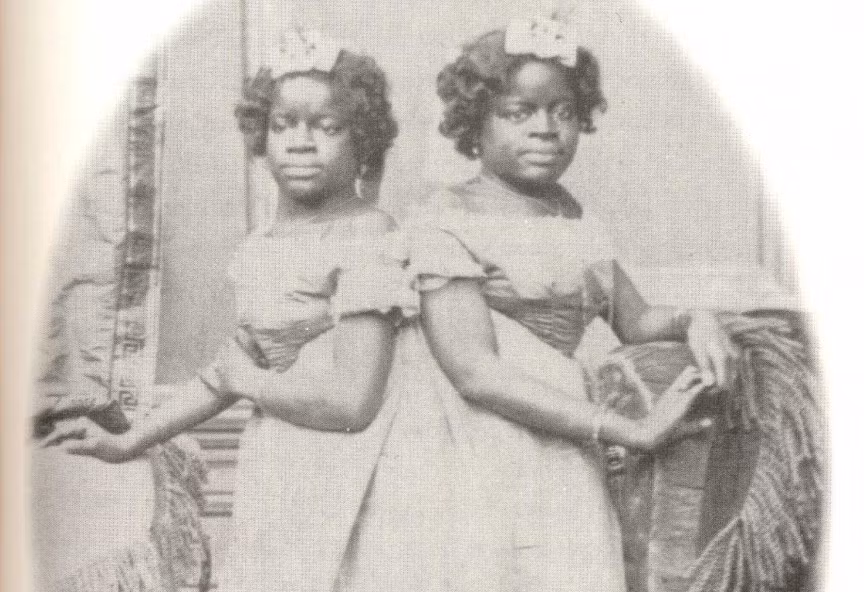 Mille và Christine McCoy là một cặp sinh đôi dính liền bị bán làm nô lệ cùng với mẹ của họ cho một ông chủ trò có tên là Joseph Smith. Joseph và vợ đã dạy dỗ cặp sinh đôi. Họ có thể nói 5 ngôn ngữ, khiêu vũ, chơi nhạc, ca hát và trở nên nổi tiếng với biệt danh “Chim sơn ca hai đầu”. Vào những năm 1880, họ giải nghệ và mua một trang trại nhỏ. Mille qua đời do viêm phổi ở tuổi 61 kéo theo Christine tử vong vài giờ sau đó. Họ trở thành một trong những cặp song sinh dính liền sống lâu nhất.