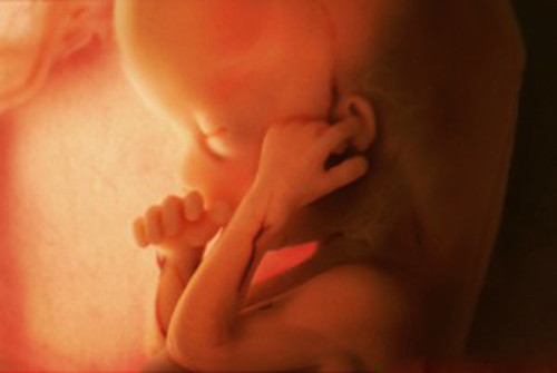 Thai nhi 14 tuần: Bắt đầu mọc tóc. Tuần này, các cơ quan sinh sản phát triển mạnh mẽ. Tuyến tiền liệt hình thành. Nếu thai nhi mang giới tính nữ thì buồng trứng hạ xuống vùng chậu từ ổ bụng và trong buồng trứng, bé đã có khoảng 2 triệu quả trứng và cho đến khi bé chào đời sẽ chỉ có thêm 1 triệu quả trứng nữa. Những trứng này sẽ trưởng thành khi bé lớn lên và chỉ chín khoảng 200.000 quả trong suốt cuộc đời mà thôi.