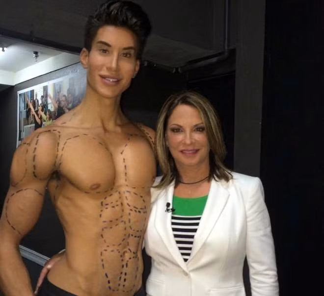 Tuy nhiên vẻ ngoài của chàng trai búp bê này lại hoàn toàn phụ thuộc vào dao kéo. Để được như hiện tại, Justin đã phải tốn hơn 100.000 USD cho 90 ca phẫu thuật thẩm mỹ.