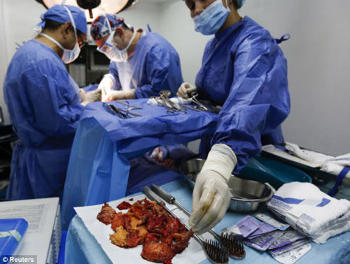 Theo bệnh sử, T và bạn đã tự ý mua silicon lỏng về bơm vào mông để có vòng 3 đạt chuẩn. T nhờ bạn chích với dung lượng mỗi mông 250cc (hai mông 500cc) bằng một loại bơm kim tiêm lớn. Sau tiêm, nạn nhân kêu đau nhức và khó thở nhiều, hai bên mông ngày càng bị sưng vù, tấy đỏ. Tuy nhiên, do silicon được chích với liều lượng quá lớn nên đã ngấm vào các mô mỡ và mạch máu, gây ra các cục tắc phổi, suy hô hấp nặng. Sau đó, bệnh nhân bị ngừng tim và tử vong.