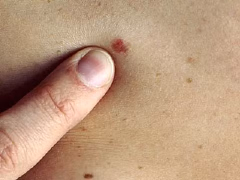 Những thay đổi bất thường trên da cũng là một trong những điều cần lưu ý.