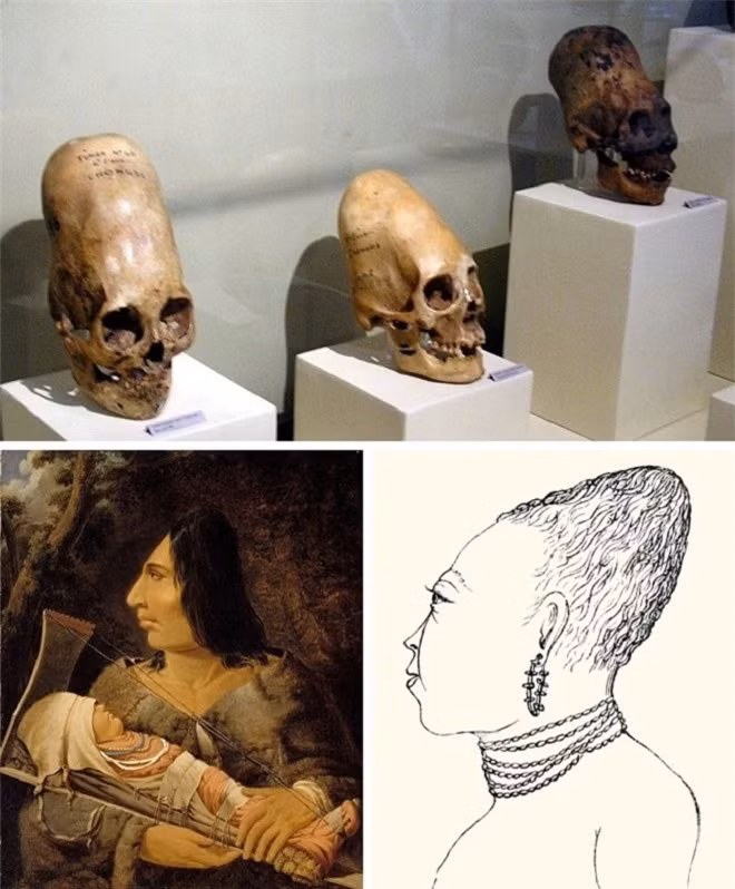 8. Kéo dài sọ: Tập tục kỳ lạ này xuất hiện ở rất nhiều cộng đồng người trên khắp thế giới. Mục đích của cách làm này là để tạo đặc điểm riêng cho từng cộng đồng người, hoặc thể hiện địa vị xã hội. 