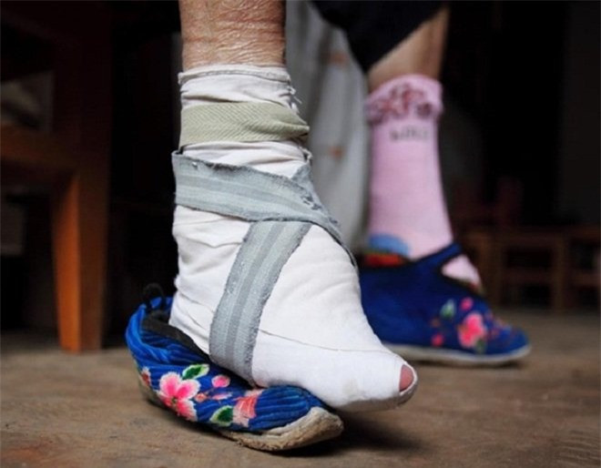 10. Bó chân: Chỉ khi có được đôi chân nhỏ nhắn, thon thả thì các thiếu nữ Trung Quốc mới mong lấy được chồng giàu sang. Trào lưu này thịnh hành gần 1.000 năm trước rồi bị hủy bỏ bởi tác hại lâu dài đối với sức khỏe. 