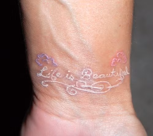 Các dân chơi cho rằng đây chính là đẳng cấp, là thú làm đẹp "độc" mặc dù nó tiềm ẩn rất nhiều nguy cơ.