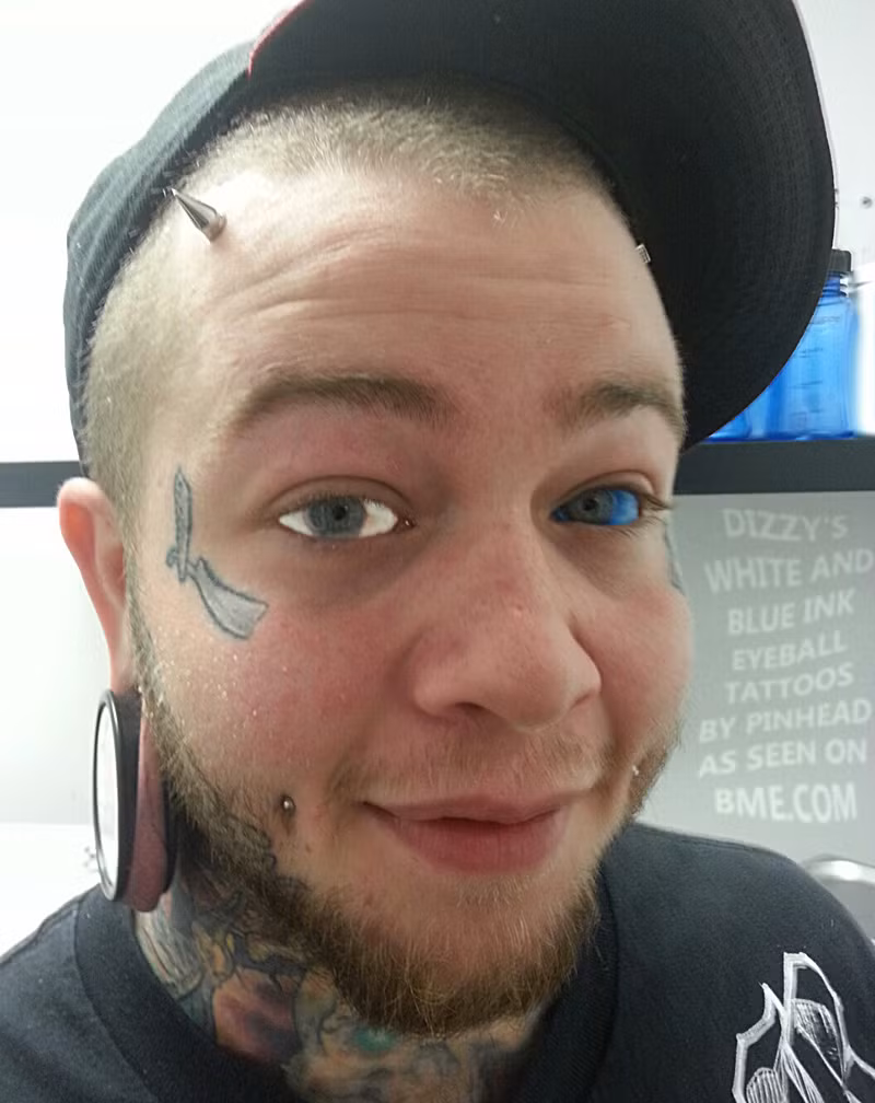 Tuy vậy, không phải người nào cũng có thể phù hợp với kiểu làm đẹp nguy hiểm này vì nó có thể gây hại cho mắt, thậm chí làm giảm thị lực và dẫn đến mù vĩnh viễn.