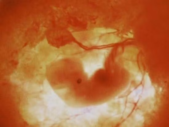 Tuần 6: Các đặc điểm trên khuôn mặt bé dần hình thành.