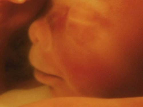 Toàn bộ người bé lúc này xuất hiện một lớp lông tơ và nó sẽ phát triển tới tận tuần cuối cùng trước khi chào đời.