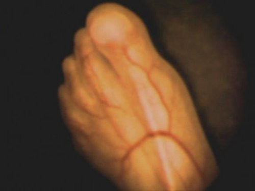 Tuần thứ 20. khung xương tiếp tục phát triển và xương sọ bắt đầu cứng lại nhưng chưa hoàn chỉnh.