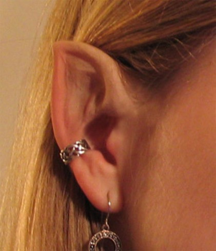 Hầu hết các bác sĩ phẫu thuật và các chuyên gia đều cảnh báo rằng việc phẫu thuật này rất nguy hiểm và đau đớn.