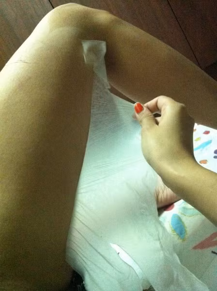 Tuy nhiên, sau khi dùng các sản phẩm này, thời gian đầu da có trắng lên nhưng sau đó lại đen nhanh chóng và không thể phục hồi trở lại. Lý do là lớp da non vừa tái tạo có khả năng chống đỡ lại ánh nắng rất yếu nên bắt nắng nhanh hơn. Và nếu ấy lại tiếp tục làm trắng thì lớp da đó chưa kịp phục hồi đã bị lột tiếp sẽ tổn thương, dẫn đến bỏng nhẹ và rát.