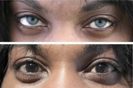 Phẫu thuật thay đổi màu mắt: Người ta đã tìm ra nhiều cách để biến những điều không thể thành có thể, như thay đổi màu mắt chẳng hạn. Không có can thiệp nào có thể biến mắt nâu chuyển sang xanh mà không có sự hỗ trợ của kính áp tròng.