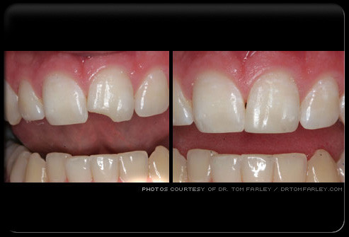 Tùy trường hợp, Nha khoa thẩm mỹ có thể bao gồm nhiều quá trình như phẫu thuật răng miệng, làm trắng răng, chỉnh nha, niềng răng, cấy ghép nha khoa, làm răng giả.