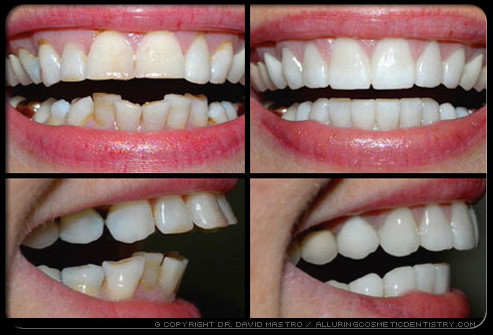 Nha khoa thẩm mỹ với nhiều phương pháp khác nhau không chỉ cải thiện nụ cười mà còn cải thiện sức khỏe răng miệng của bạn.