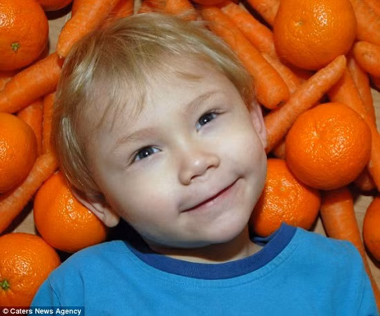 Không cho bé ăn quá nhiều cà rốt. Cà rốt có chứa nhiều carotene rất tốt cho trẻ. Thế nhưng mẹ nên lưu ý cho con ăn điều độ. Trẻ nhỏ uống quá nhiều nước ép từ cà rốt hoặc cà chua có khả năng bị tăng lipit máu, khuôn mặt và da bàn tay biến thành màu da cam, chán ăn, tinh thần bất ổn, hay bồn chồn, thậm chí khó ngủ, hay sợ hãi ban đêm, quấy khóc liên miên.