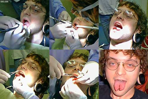 Đây là một quá trình không những đau đớn mà còn có thể nguy hiểm đến tính mạng.