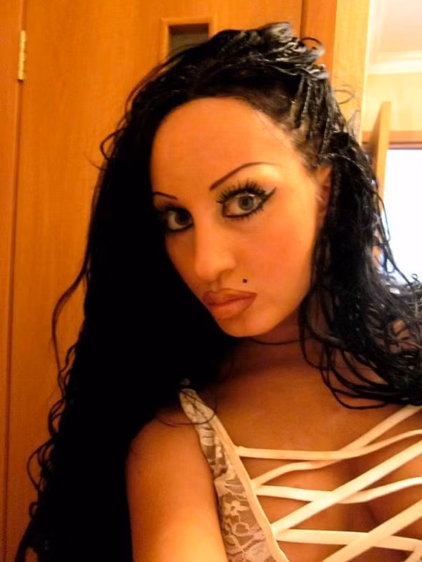 Tất cả những lần phẫu thuật đó khiến diện mạo cô hoàn toàn khác biệt, thậm chí là kinh dị hơn nhan sắc bình thường trước khi làm đẹp bằng dao kéo.