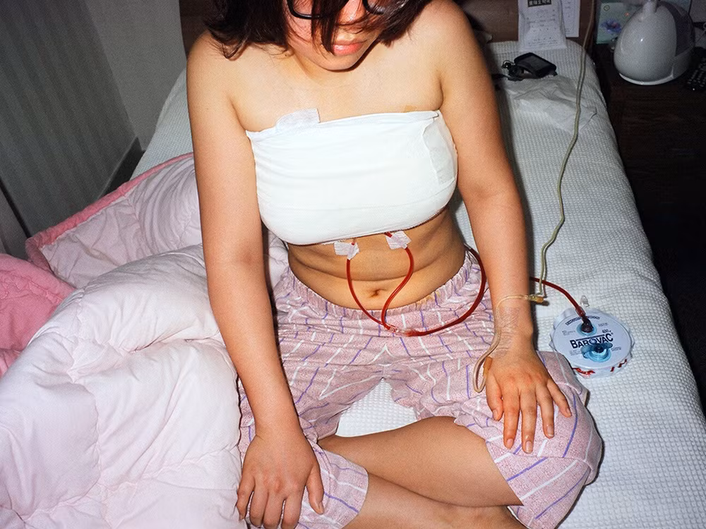 Việc trải qua dao kéo, chịu đựng những vết thâm tím, sẹo và vài lần gây mê có vẻ không khiến các thiếu nữ lo sợ.