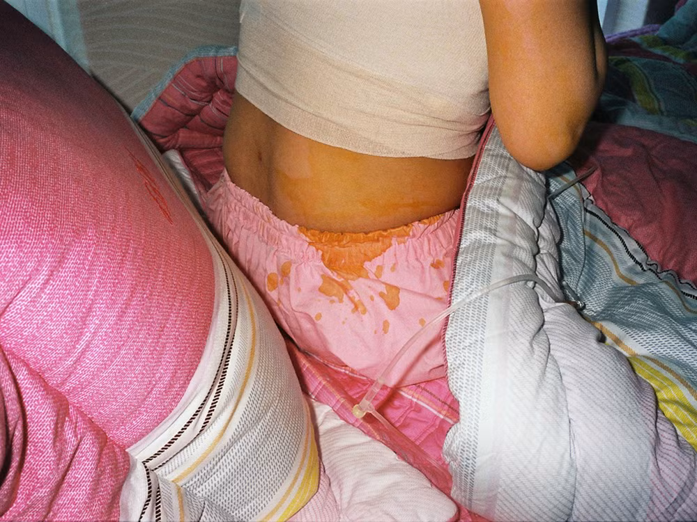 Những vết máu tươi còn chưa kịp khô trên cơ thể cô gái này.