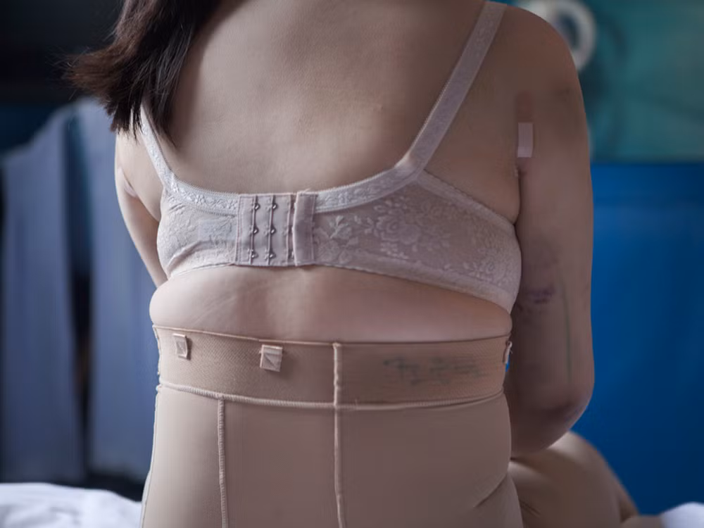 Những cô gái có thân hình không như ý này dường như bị ám ảnh bởi công nghệ làm đẹp dao kéo