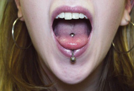 Tuy nhiên, đeo một chiếc khuyên trong lưỡi gây ra cảm giác cực kỳ đau đớn và khó chịu.