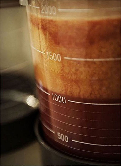 Bước 5: Tiếp tục đưa dụng cụ vào vùng cần hút mỡ. Tùy loại dụng cụ sẽ phá vỡ cấu trúc của mô mỡ, từ đó chúng dễ dàng đi qua ống hút mỡ, mỡ thừa sẽ được hút ra ngoài.