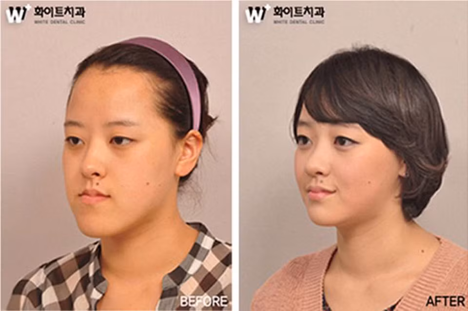 Những khuôn mặt không được như ý, cằm thô bè, mắt một mí bỗng chốc lát đều trở nên hoàn hảo.