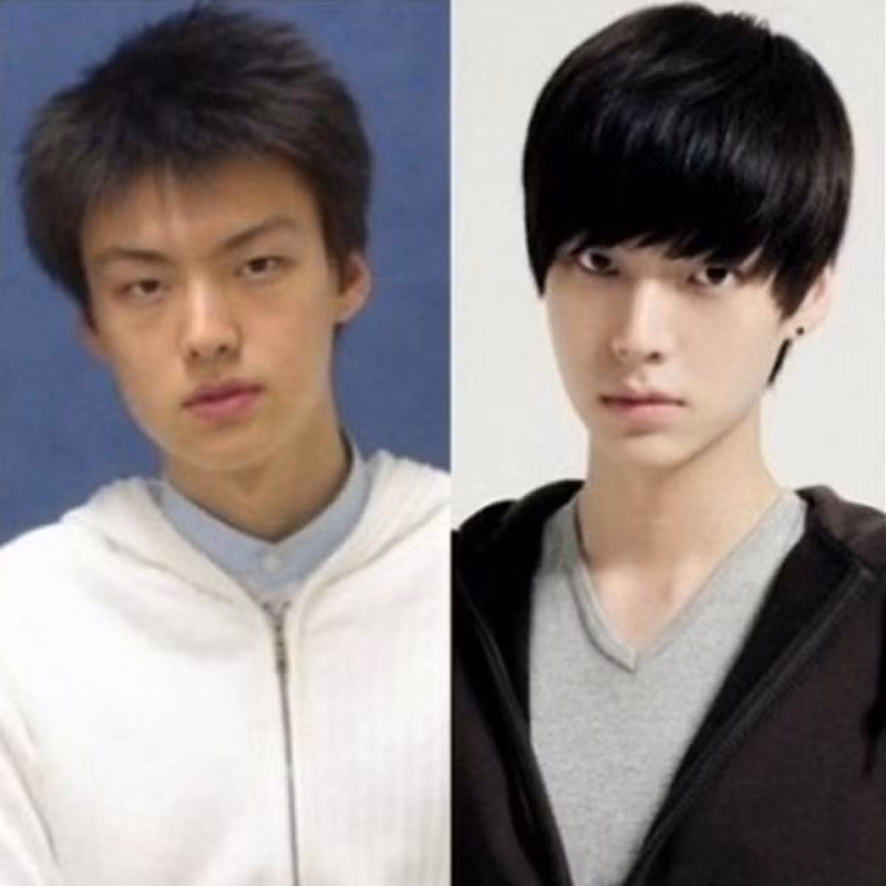 Rất nhiều chàng trai tìm đến công nghệ dao kéo để có được vẻ đẹp hotboy.