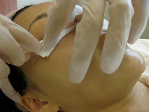 Không dừng lại ở đó, phần bọng mắt của Trần Lợi Mẫn cũng được "phù phép" sau đó ít lâu. Bác sĩ cắt đi phần bọng mắt để đôi mắt thêm nhẹ nhàng và giảm thiểu dấu hiệu mệt mỏi.