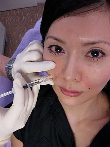 Đến năm 2008, cô bắt đầu "nghiện" phẫu thuật thẩm mỹ khi liên tục là khách quen ở thẩm mỹ viện với vô vàn dịch vụ làm theo...tuần. Tiêm botox để xóa nếp nhăn vùng khóe miệng...