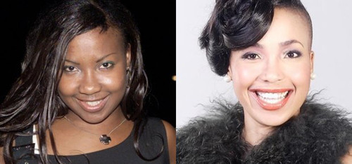 Mshoza, một ca sĩ có tiếng ở châu Phi đã tốn rất nhiều tiền để có làn da trắng, cô thấy mình xinh đẹp và tự tin hơn rất nhiều.