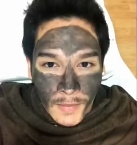 Chàng trai giấu tên này cho biết: “Tôi đã cố gắng làm phẫu thuật để trở thành một người đàn ông đẹp hơn. Sau phẫu thuật cuộc sống của tôi đã thay đổi hoàn toàn”.