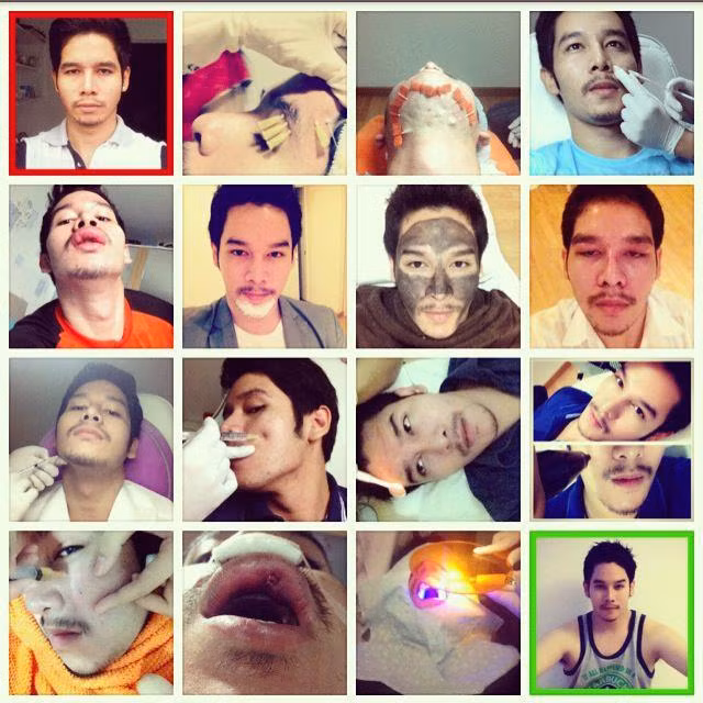 Toàn cảnh công cuộc đại tu sắc đẹp của chàng trai này.