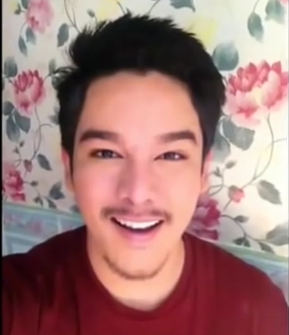 Gương mặt quyến rũ và trở nên thay đổi hoàn toàn sau công cuộc đại tu nhan sắc.