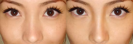 Nếu mũi quá dài so với khuôn mặt, đánh phấn màu đậm lên phần chóp mũi, đồng thời dùng chì kẻ hạn thấp đầu chân mày để che bớt phần trên của sống mũi.