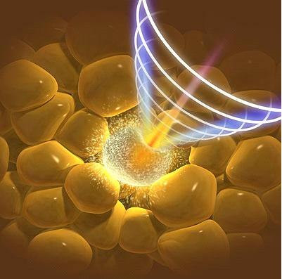 Các mô mỡ bị phá hủy bởi tia lazer.