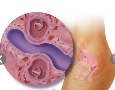 Bốn tuần tuổi: Hai phôi thai, bao gồm hai lớp tế bào sẽ tạo thành tất cả các bộ phận cơ thể và tay chân của em bé sau này. Tuần tới, hai phôi sẽ phát triển túi ối và nhau thai của mình.