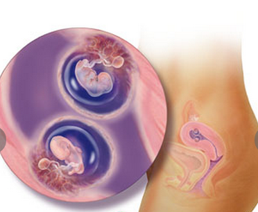 8 tuần tuổi: Cặp song sinh tại thời điểm 8 tuần đã phát triển cánh tay và chân uốn cong, các tế bào thần kinh của em bé đã phát triển và kết nối với nhau. Các bé đã có "thần giao cách cảm" rồi.