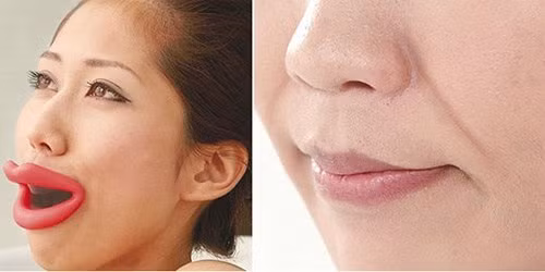 Môi nhân tạo. Dụng cụ tạo dáng và làm săn chắc vùng miệng có hình dáng giống hệt như đôi môi của bạn.