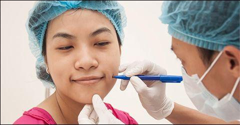 Trước khi phẫu thuật tạo má lúm đồng tiền, các bác sĩ sẽ xem xét khuôn mặt, xác định điểm cần tạo má lúm sao cho phù hợp với từng khuôn mặt.