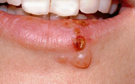 Các nhà khoa học ở Mỹ, Italia… đã thực hiện nhiều cuộc kiểm định mực xăm, và phát hiện trong các loại mực này chứa nhiều thành phần như: chì, titan, cadmium, thuỷ ngân, nicken, cobalt, đồng cùng nhiều kim loại nặng khác đã bị liệt vào danh sách chất độc hại.