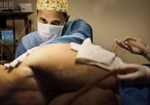 Bước 5: Tiếp tục đưa dụng cụ vào vùng cần hút mỡ. Tùy loại dụng cụ sẽ phá vỡ cấu trúc của mô mỡ, từ đó chúng dễ dàng đi qua ống hút mỡ.