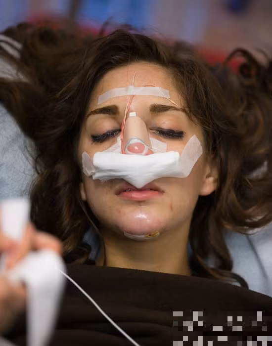 Để có được sắc đẹp như ý, cô phải trải qua những tận cùng của đau đớn.