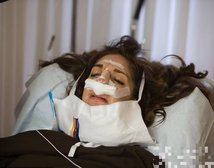 Ngoài độn cằm, cô cũng thực hiện chỉnh sửa lại chiếc mũi cho vừa ý.