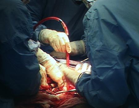 Nhiều bác sĩ phẫu thuật thường xuyên quên dị vật trong cơ thể người bệnh. Hình minh họa