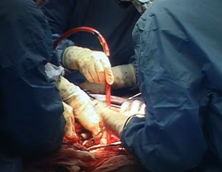 Nhiều bác sĩ phẫu thuật thường xuyên quên dị vật trong cơ thể người bệnh. Hình minh họa Nhiều bác sĩ phẫu thuật thường xuyên quên dị vật trong cơ thể người bệnh. Hình minh họa